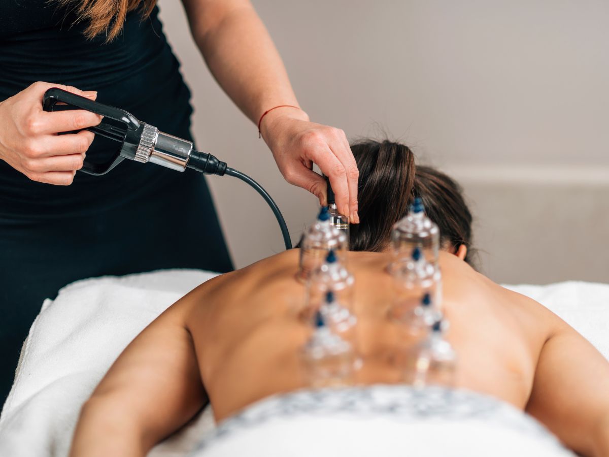 Read more about the article Embracing Wellness: Exploring the Multifaceted Benefits of Cupping Therapy